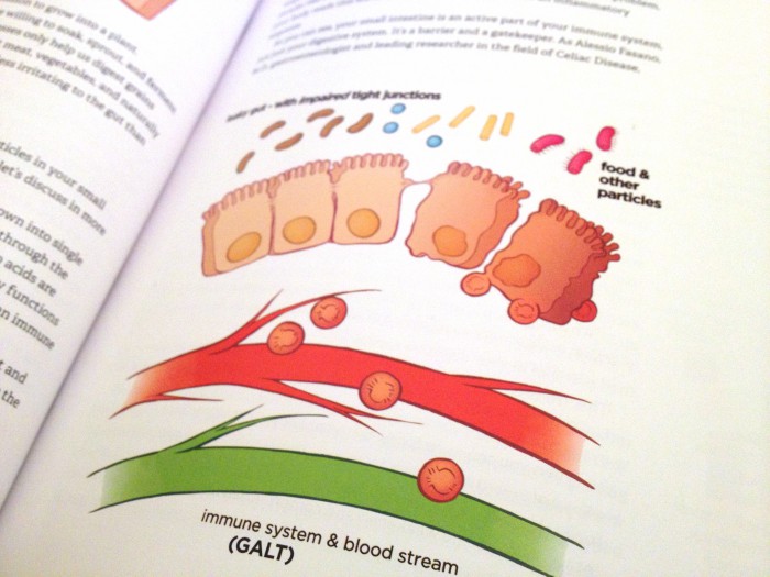 How does Leaky Gut Happen?